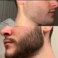 بمب معجزه