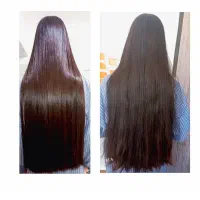 کراتین بوتاکس