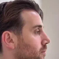 تخفیف عمل و جراحی بینی لیفت صورت ابدو لیپو ساکشن|خدمات آرایشگری و زیبایی|تهران, حصار بوعلی|دیوار