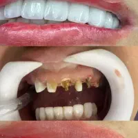 دندانپزشکی صدف (با شرایط اقساط) کامپوزیت|خدمات آرایشگری و زیبایی|قم, حقیقت|دیوار