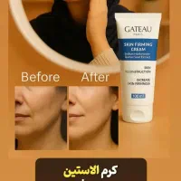 کرم جوانساز دست|آرایشی، بهداشتی، درمانی|شیراز, شهرک مطهری|دیوار