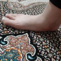 تجربه جراحی صافی کف پا درخواست راهنمایی از دوستان