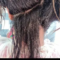 جمع آوری شپش قفط دریک جلسه