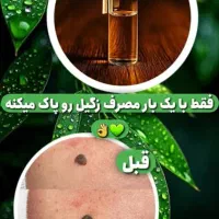 تو سه روز هر چی منگوله داری رو پاک کن