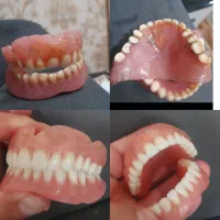 چی بود و چی شد دندان مصنوعی|فعالیت داوطلبانه|ایجرود, |دیوار