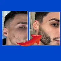 یکماهه ریش دربیار