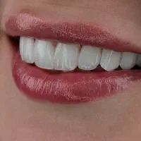 تخفیف کامپوزیت لیرینگ فقط ۴۵ ت دوفک