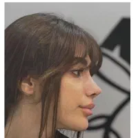 عمل جراحی بینی از۲۰م/قسطی/ لیپو/رضایت۱۰۰٪