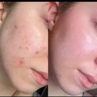 کرم سفید کننده|آرایشی، بهداشتی، درمانی|زابل, |دیوار