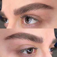 مدل میکروبلیدینگ و فیبروز ابرو