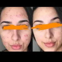 درمان پوست ومو|آرایشی، بهداشتی، درمانی|نهبندان, |دیوار