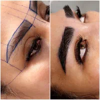 میکرو کاشت ابرو، کاشت مو اف یو ای پلاس