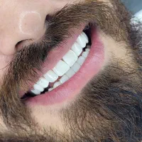 کامپوزیت زیبایی|خدمات آرایشگری و زیبایی|تهران, اباذر|دیوار