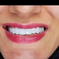 اجاره-انبار