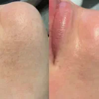 فیشال مدل|خدمات آرایشگری و زیبایی|اصفهان, سرچشمه|دیوار