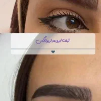 تخفیف پاییزی بوتاکس کلینیک زیبایی|خدمات آرایشگری و زیبایی|اردبیل, |دیوار