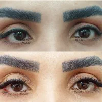 کاشت هرمدل مژه