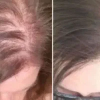 موهات جنگل آمازون میشه