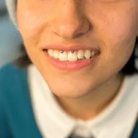 انجام پیرسینگ تخصصی بدن توسط پزشک در یزد|خدمات آرایشگری و زیبایی|یزد, |دیوار