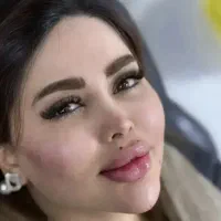 تزریق فیلر لب،زاویه،چونه ،سیب وکات ۸۰۰ بوتاکس ۶۵۰|خدمات زیبایی و سلامت|تهران, سلسبیل شمالی|دیوار