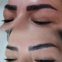 فیبروز و ترمیم تخصصی ابرو