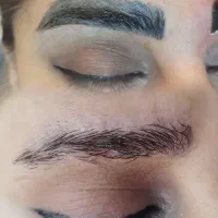 پاک کردن تتوهای صورت وبدن|خدمات آرایشگری و زیبایی|کرمان, |دیوار