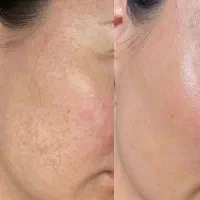 پوست جوان‌تر و شفاف در سال نو