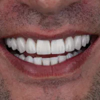 دستیار و منشی دندانپزشکی