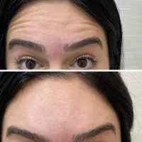 ورق بزن اسلایدها رو ببین ...خدمات بوتاکس،فیلرصورت