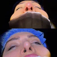 جرای و زیبایی صورت و بینی