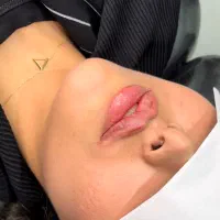 بوتاکس ژل انزیم