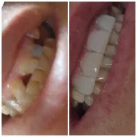 ترمیم و زیبایی|خدمات آرایشگری و زیبایی|یاسوج, |دیوار