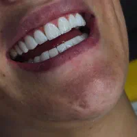 دندانپزشکی باتعرفه دولتی عصب‌کشی کامپوزیت|خدمات آرایشگری و زیبایی|تهران, تهرانپارس غربی|دیوار