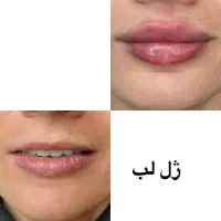 فرصت ویژه روز مادر خدمات زیبایی در منزل