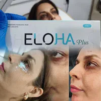 مرکززیبایی و لیزر آکو|خدمات آرایشگری و زیبایی|اندیمشک, |دیوار