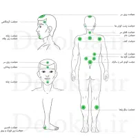 انواع حجامت و بادکش و فصد خون در مطب و در منزل|خدمات آرایشگری و زیبایی|پاکدشت, پاکدشت (مامازند)|دیوار