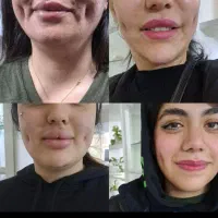 مدل پیرسینگ میکرو.چالگونه.نگین دندان توسط متخصص|خدمات آرایشگری و زیبایی|مشهد, شهید فرامرز عباسی|دیوار