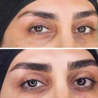 میکروبلیدینگ ابرو،شیدینگ لب،خط چشم و بن مژه.