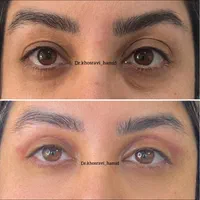 کلینیک زیبایی و جراحی بلفاروپلاستی و بینی