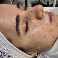 آموزش تخصصی فیشال و پاکسازی پوست|خدمات آموزشی|ارومیه, |دیوار