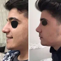 عمل بینی و جراحی لیپوساکشن با تیم پزشکان|خدمات زیبایی و سلامت|تهران, فلسطین (میدان انقلاب)|دیوار