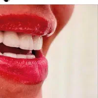 انجام کلیه خدمات دندانپزشکی قرارداد بانک سپه ورفاه