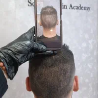 میکرواسکالپ سر ،اسکالپ سر ، پرپشتی مو در مطب پزشک|خدمات آرایشگری و زیبایی|اهواز, کیانپارس |دیوار