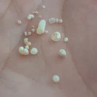 مروارید صدف