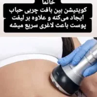 اندام ساعت شنی تا عید بدون جراحی و دمنوش