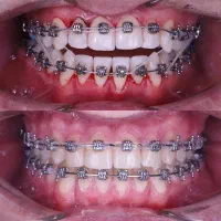 تمامی خدمات دندانپزشکی با بهترین کیفیت و اقساطی|خدمات آرایشگری و زیبایی|ماکو, |دیوار