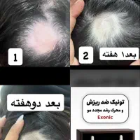 تونیک ضد ریزش و محرک رشد مجدد مو با اپلیکاتور|آرایشی، بهداشتی، درمانی|بابل, |دیوار