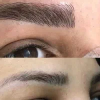 میکروبلیدینگ