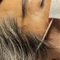 «کاشت ابرو طبیعی در بوشهر تیم پزشکی مجرب|خدمات آرایشگری و زیبایی|بوشهر, |دیوار