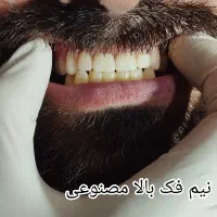 دندانسازی ، دندان مصنوعی|خدمات آرایشگری و زیبایی|مشهد, راه آهن|دیوار